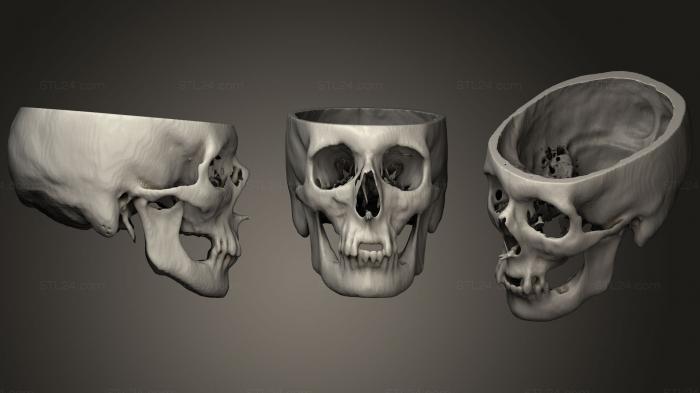 Анатомия скелеты и черепа (Череп Мужской 60лет, ANTM_1294) 3D модель для ЧПУ станка